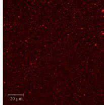 Microscopia: Leite homogeneizado